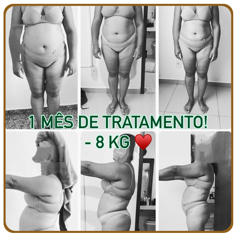resultado-emagrecimento 06